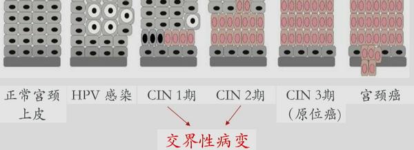 择优理赔有实效性吗,择优理赔最新案例