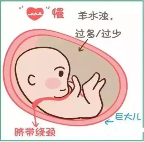 不用再找了，最全孕期产检时间表在这里！