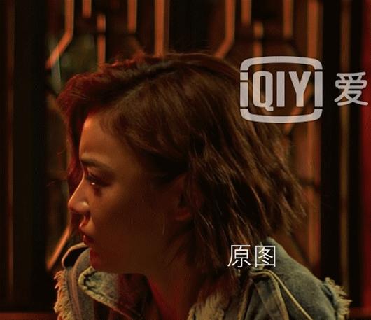 凹面型侧脸怎么改善,凹面型侧脸是怎么造成的