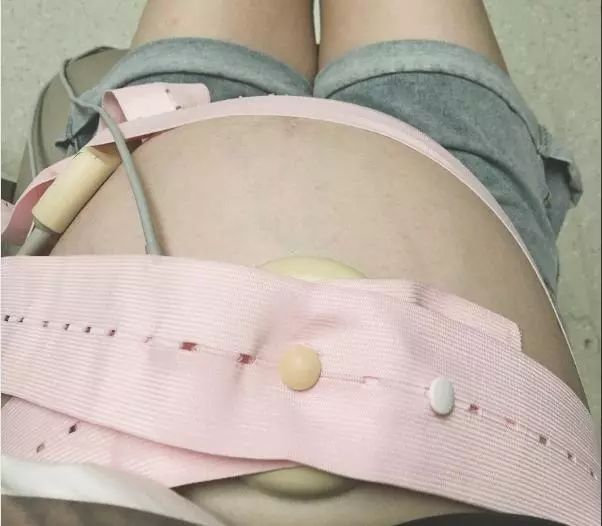 首胎想顺产？孕晚期需做好这几点