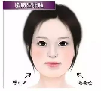 瘦脸针的5个常见问题,瘦脸针其实副作用挺大的