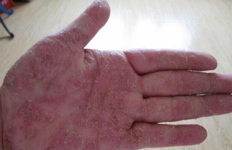 小孩子要不要买皮床,儿童选皮床好么