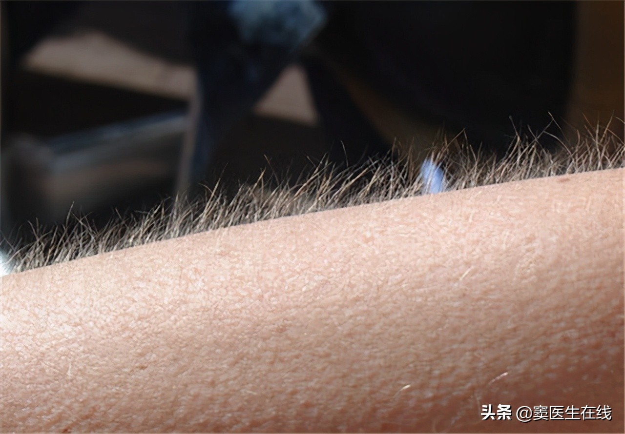 体毛要不要刮掉要一直处理吗,体毛刮掉对身体有什么影响