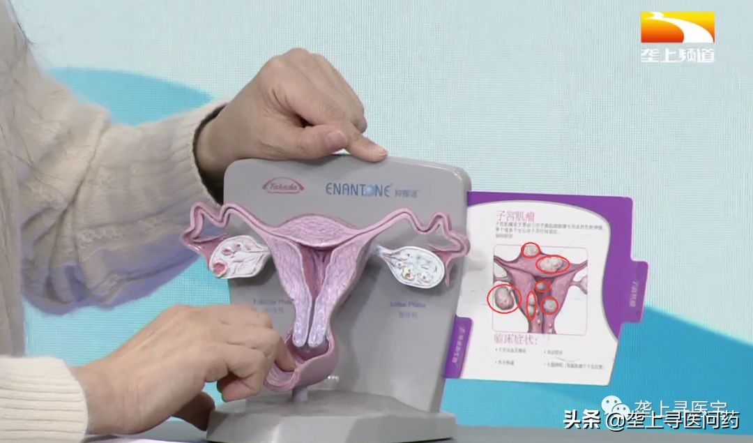 囊肿肌瘤息肉,囊肿结节息肉肌瘤的根本原因