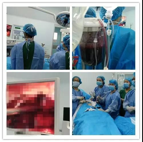 月经老是不干净,警惕内膜病变