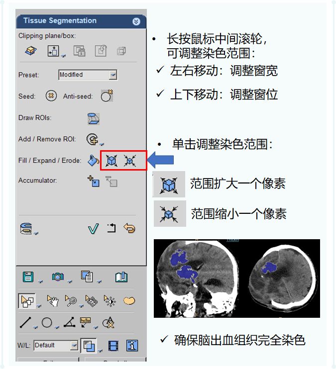 ct后处理重建技术,ct后处理技巧