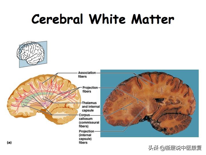 中枢神经系统断层解剖讲解,中枢神经3d解剖动画
