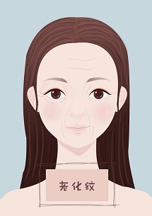 教你淡化法令纹真的很实用哦,教你淡化法令纹的好方法