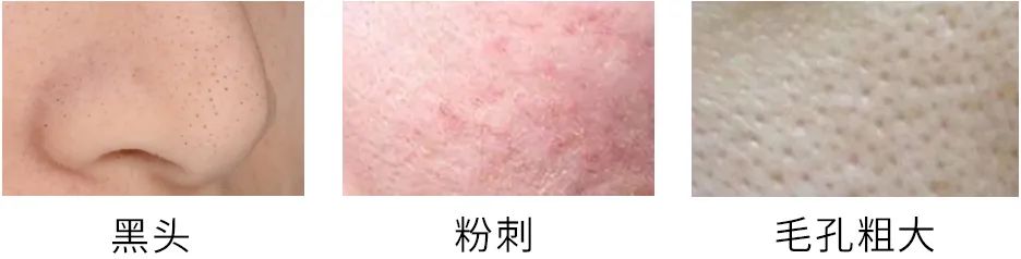 科颜氏白泥优惠价,科颜氏白泥正确使用方法时间