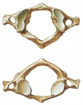 颈椎腰椎疾病ct及mri诊断,腰椎ct可以发现肠部病变吗