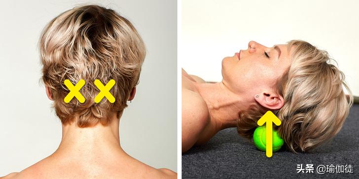 颈椎富贵包怎么消除最有效方法,怎样快速消除颈椎的富贵包