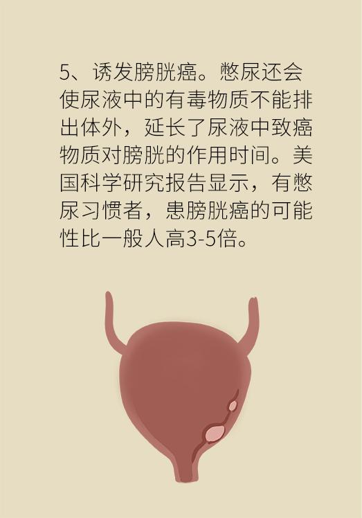 男性不卫生对女性的危害,女人不良生活习惯危害