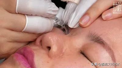 眼睛戴美瞳有血丝红肿怎么办,眼睛戴了美瞳红肿一碰就痛