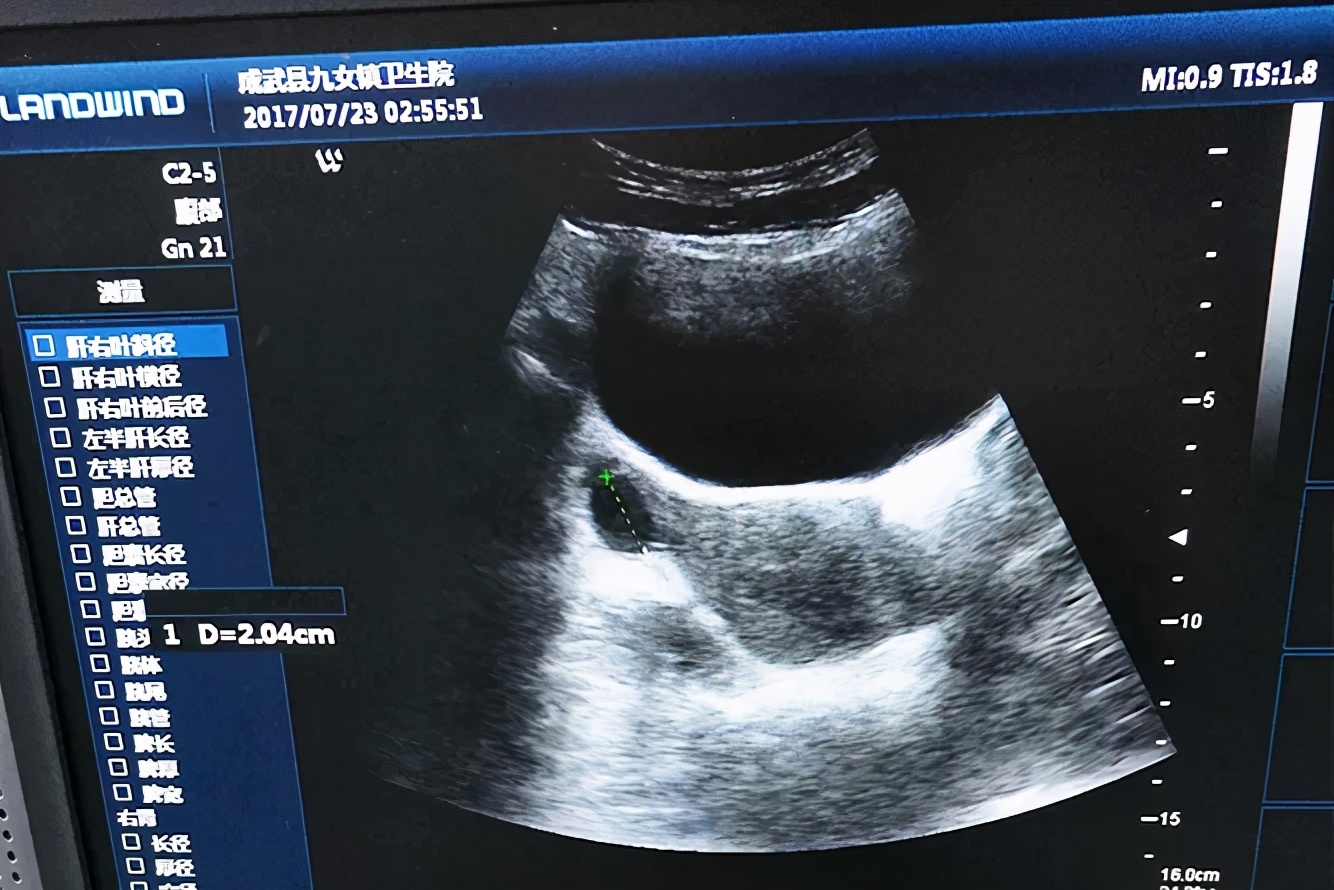 彩超坏了怎么维修,彩超设备常见故障及维修方法