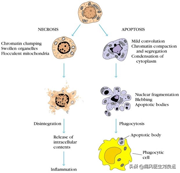 痛风是遗传因素大还是后天因素大,痛风是不是有遗传的因素呀