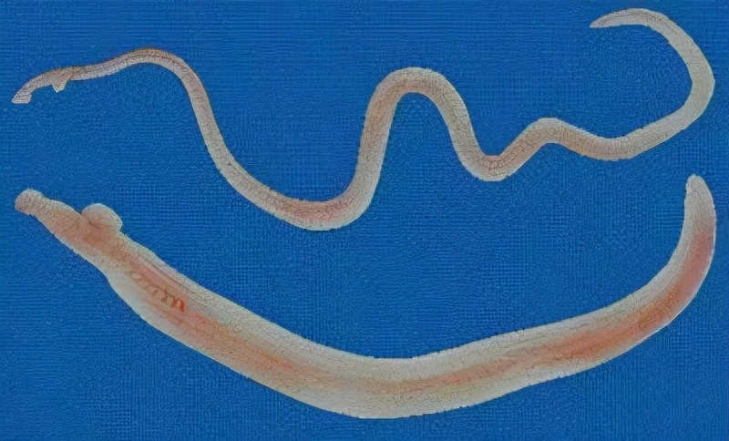 经常“肛门瘙痒”？可能与这5个原因有关，别害羞，及早了解一下