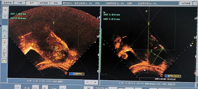 聚焦女性健康温暖牵动全球——省妇幼保健院积极响应“三八”全球多中心远程协同手术保子宫公益行动