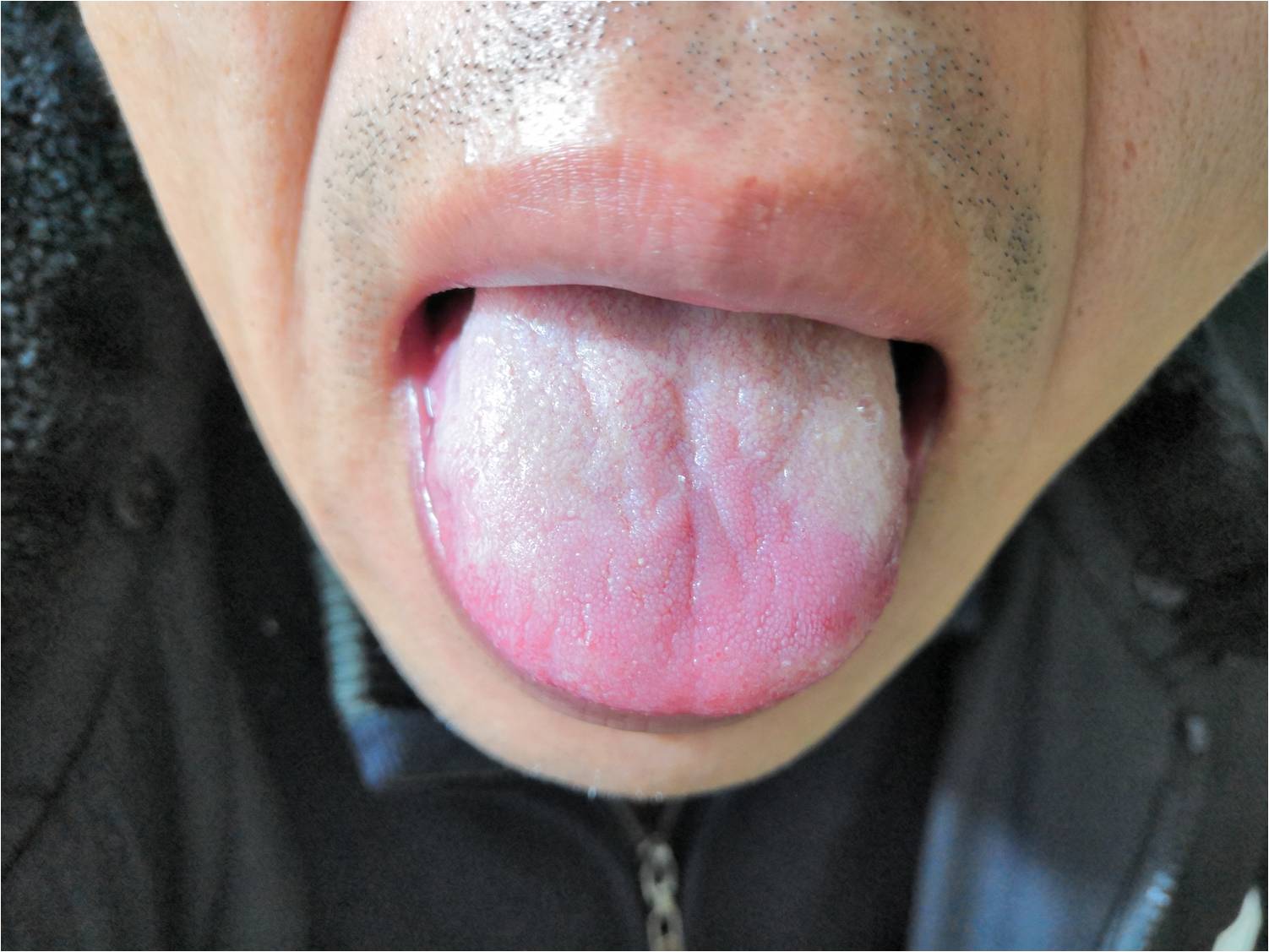 千寒易除一湿难去中医8法祛湿邪,千寒易除一湿难祛全诗