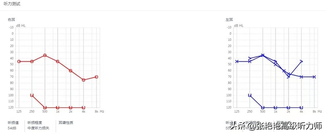 噪声污染程度分析,噪声污染的危害视频