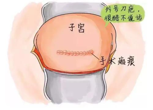 第25课主要内容,孕多少周最适合剖宫产
