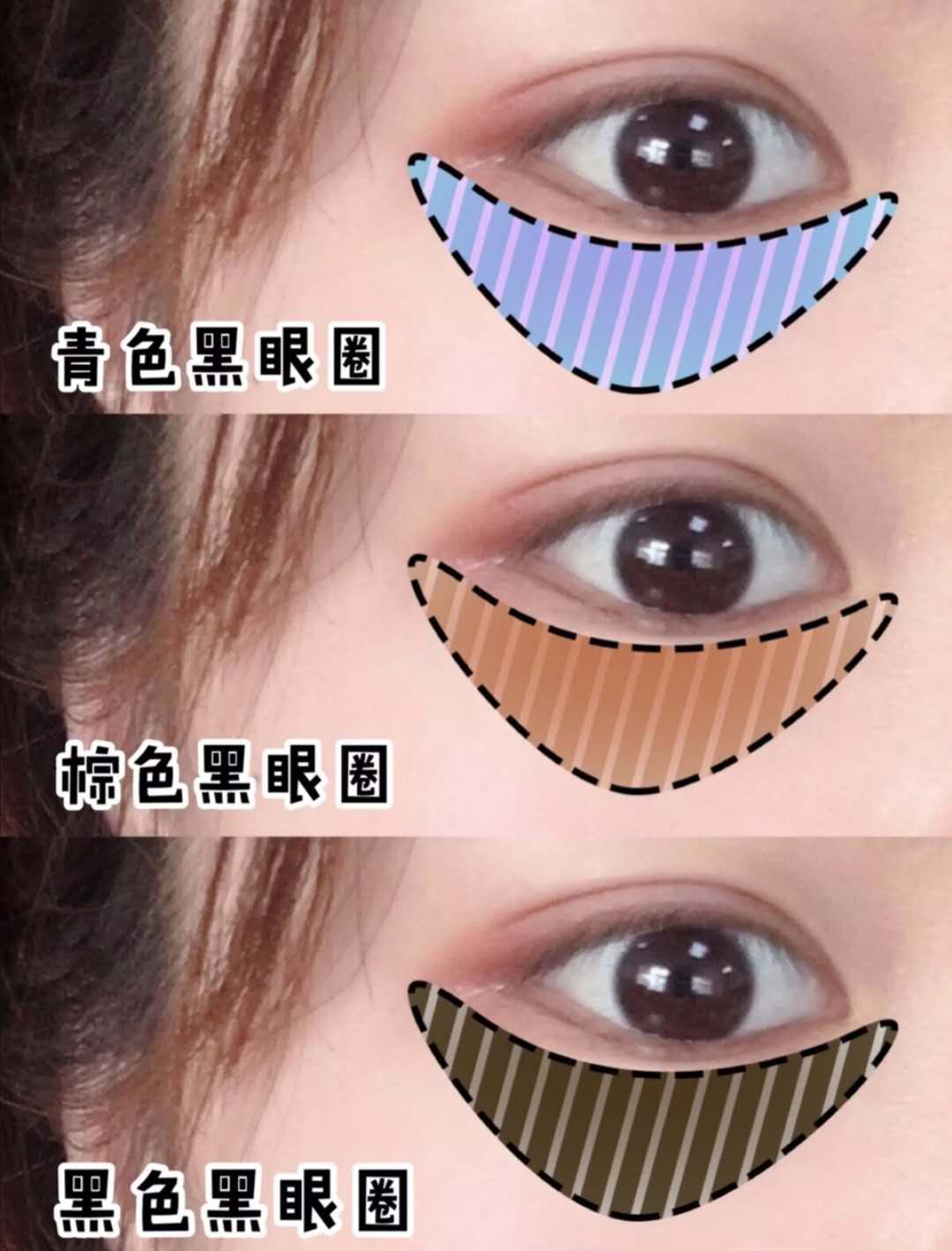 黑眼圈很重怎么办男士,黑眼圈很重怎么办中医教你