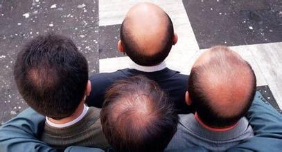 人到中老年脱发特别严重怎么治,人到中年如何摆脱脱发问题