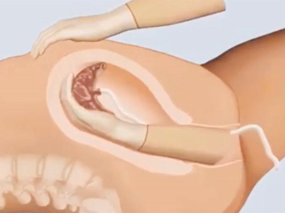 生孩子时女性骨盆的变化,生孩子产道会扩张到多少cm