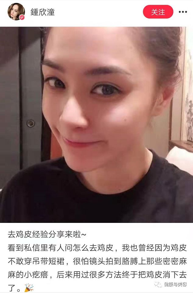 38岁阿娇沉迷于祛痘、去黑头的教学，居然很实用