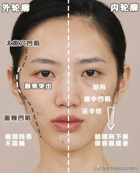 后期如何提升脸部平整度,凹陷脸如何变饱满