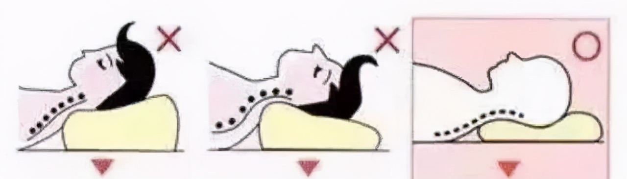 腰椎间盘突出微创要躺多久,腰椎间盘突出可以躺沙发吗