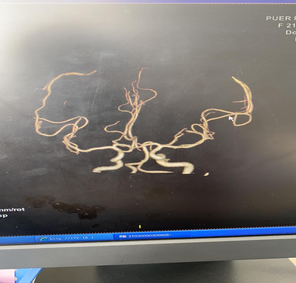 普洱市人民医院神经内科,思茅区人民医院神经外科
