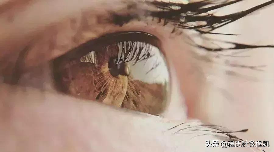 眼底黄斑变性中医治疗法,干眼症黄斑病变中医能治好吗