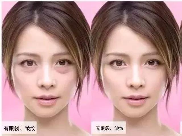 眼膜学生党去黑眼圈男生,眼膜男用