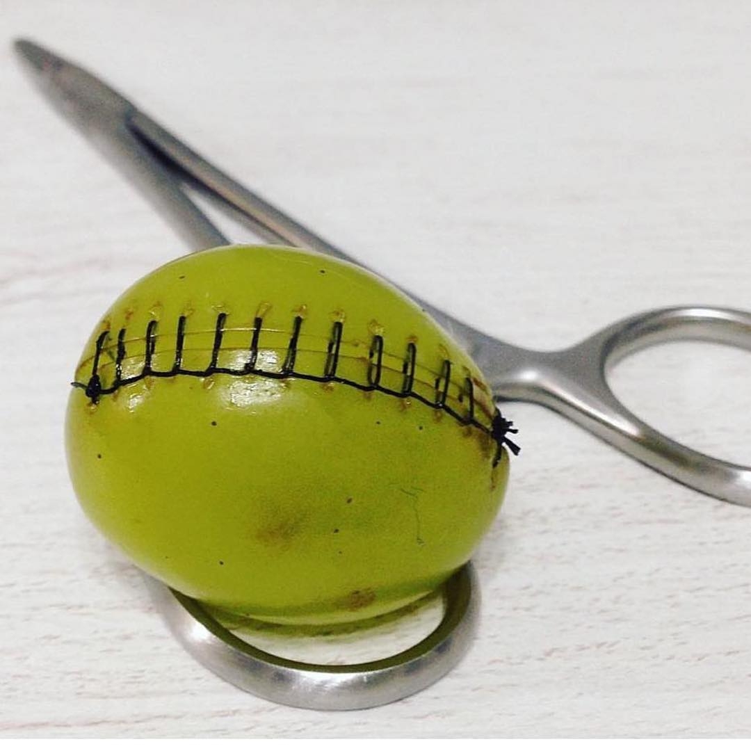 医生在手术中用烙铁止血,是真的吗?快来看看医生都有哪些*器武**