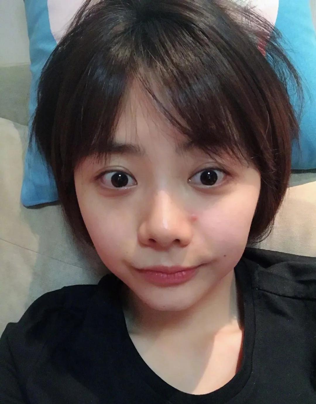 每到换季就会爆痘,换季时爆痘