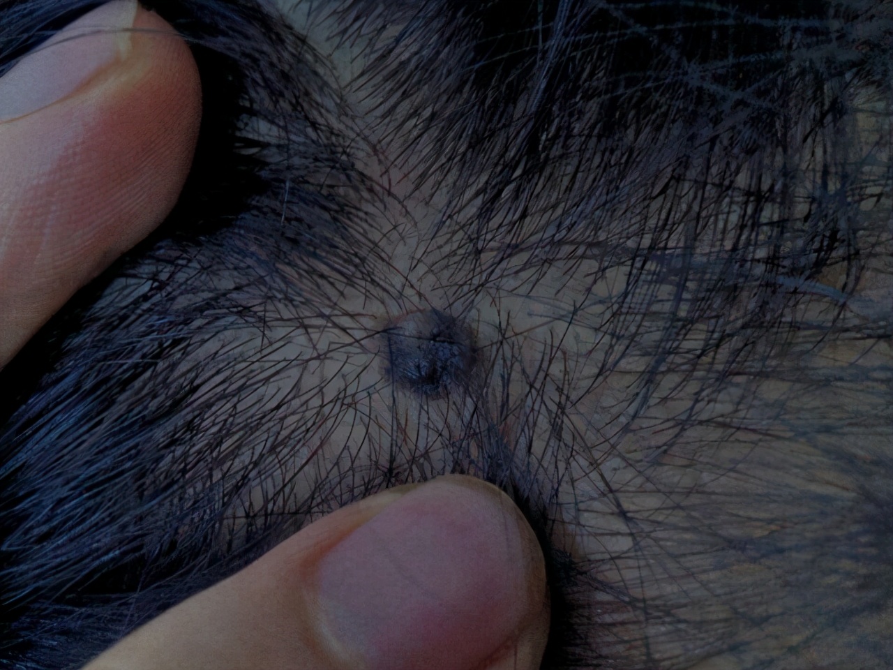 宝宝背后有痣代表什么,宝宝身上的痣会随着身体长吗