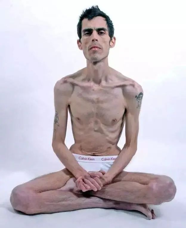 嘴管不住，瘦身靠吐——催吐减肥有多伤？