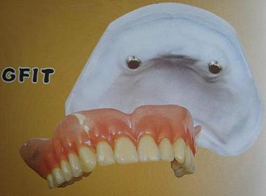 各类假牙价格,最便宜的假牙多少钱一颗