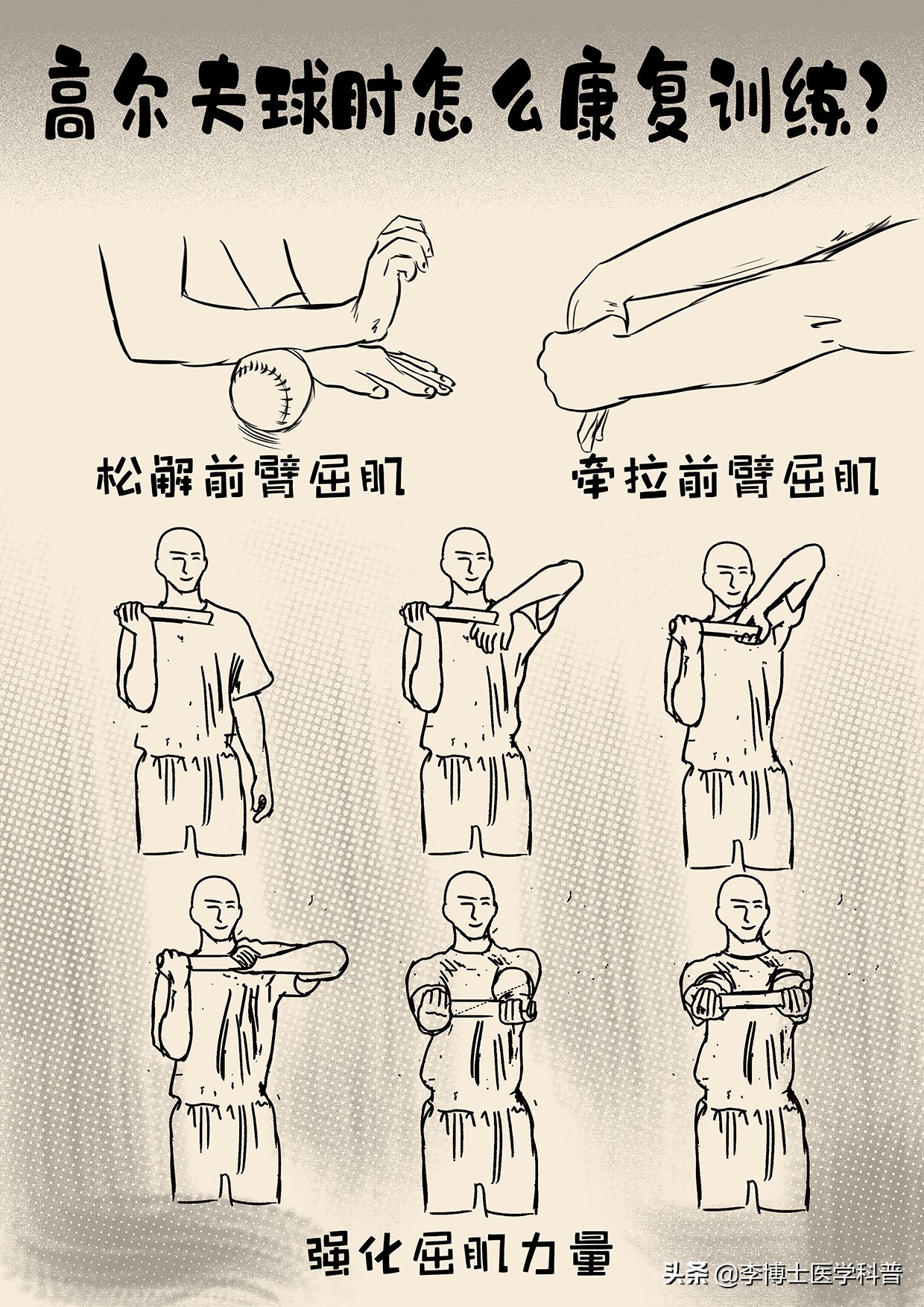 网球肘和高尔夫球肘会同时得吗,网球肘和高尔夫肘如何防治