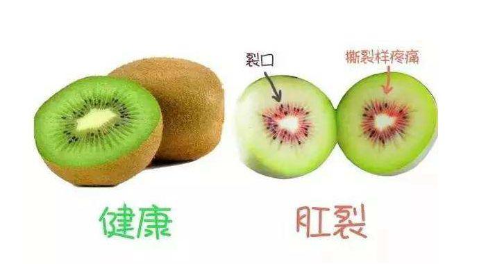 反复肛裂不见好怎么办,肛裂为啥老是开裂和痒