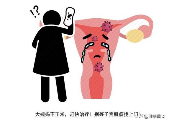 生理期有血块、小碎肉排出是疾病的表现？医生：或与3个原因有关