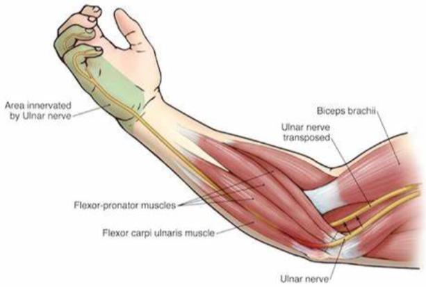 趴在床上玩手机胳膊麻,躺床上玩手机导致手麻头晕