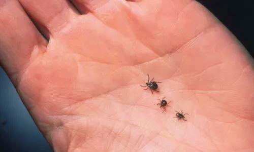 蜱虫咬人后怎么治疗处理,蜱虫咬人后怎么弄下来