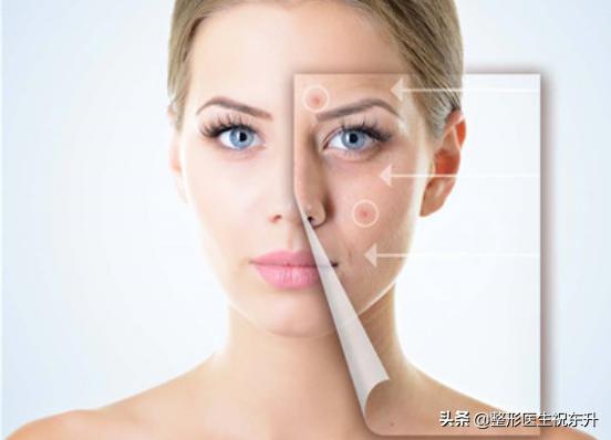 激光抗衰术,做激光有害吗