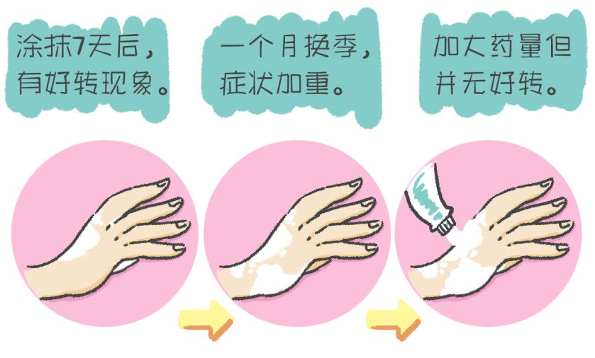 白癜风援助申请填写,白癜风援助计划