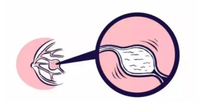 好文收藏|得了妇科病，还能买保险吗？