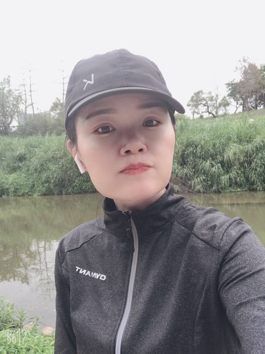 眼球突出割双眼皮好看吗,割双眼皮的危害