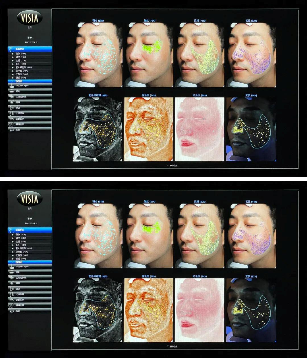 碧欧泉美白祛皱,碧欧泉美白抗老