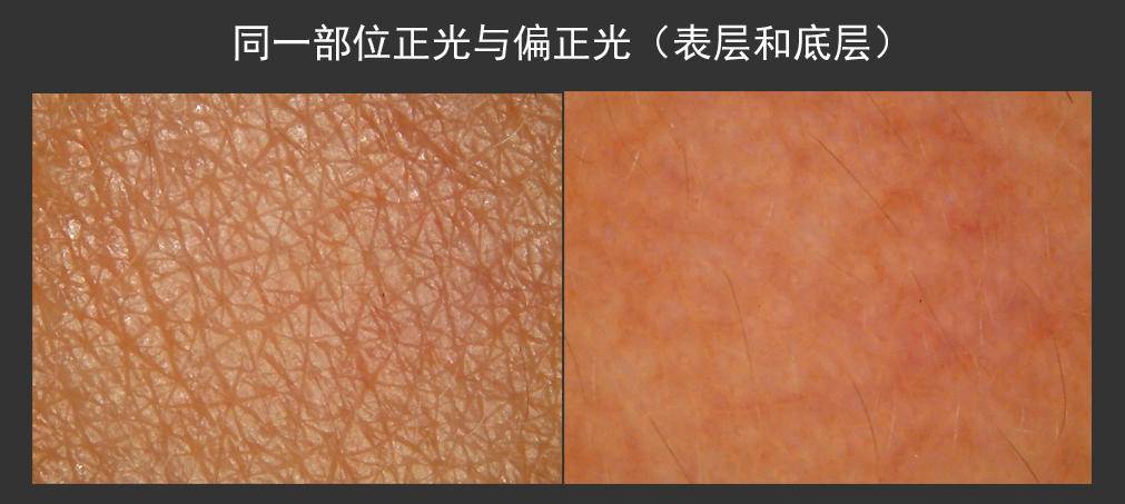 4款美容仪28天真人实测，用数据告诉你哪个好