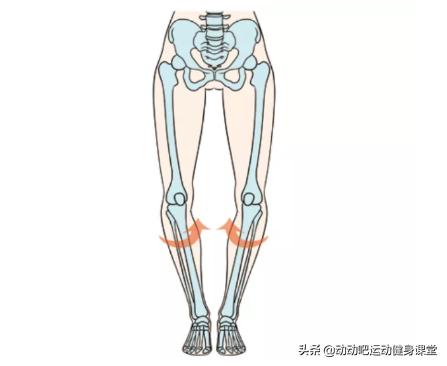 o型腿该怎么拯救,o型腿怎么拯救